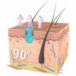 90 graus - fixação 2 90 graus - fixação 2